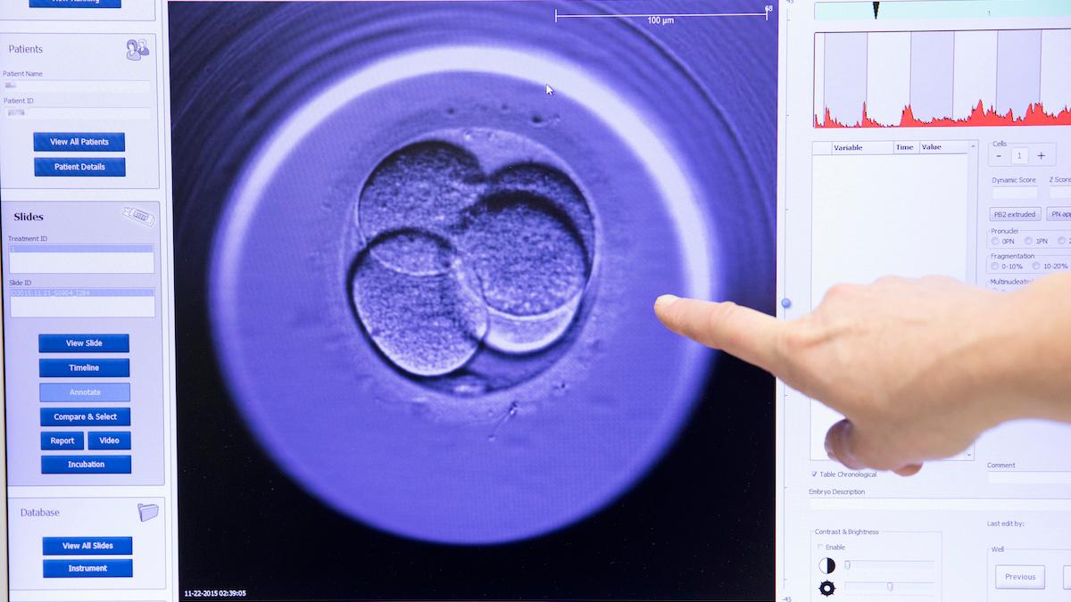 Utvärdering av ett embryo för assisterad befruktning. I Region Skåne har pandemin gjort att väntetiden för att få hjälp att få barn är orimligt lång