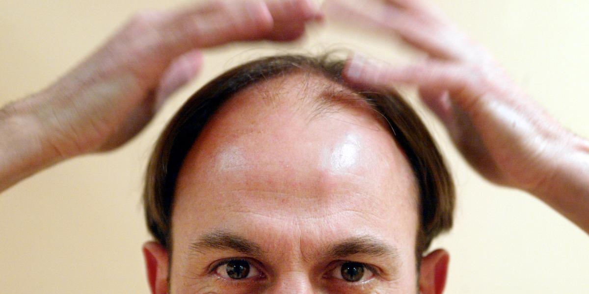 Med de här kontrollerna kan neurologer ta reda på hur din hjärna mår och göra antaganden om din risk att drabbas av demens